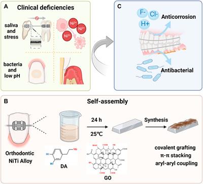 Bio-inspired nanocomposite coatings on orthodontic archwires with corrosion resistant and antibacterial properties